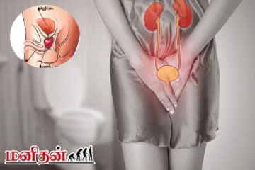 சிறுநீர் கழித்த பிறகும் சொட்டுகள் வெளியேறுகிறதா? இந்த நோயின் அறிகுறியாகும்
