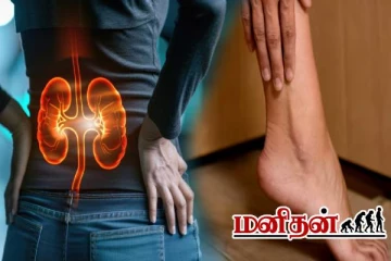 இந்த இடத்துல வலி வந்தால் உடனே சோதனை பண்ணுங்க- சிறுநீரகம் ஆபத்து வாய்ப்பு அதிகம்!