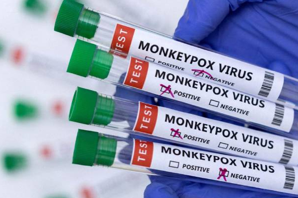 கொடிய நோய்யை எதிர்கொள்ள தயாராகிவரும் இலங்கை! | Monkeypox Virus Sri Lanka Warning Who Emergency