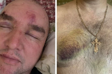 உக்ரைனில் ரஷ்யாவின் பாரிய சித்திரவதைகள்! அம்பலப்படுத்தும் சாட்சியங்கள்