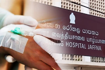 யாழில் சிறுமியின் கை அகற்றப்பட்ட விவகாரம்! சட்ட வைத்திய அதிகாரியின் அறிக்கை நீதிமன்றில் சமர்ப்பிப்பு