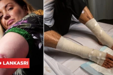 அவுஸ்திரேலியாவில் பரவும் சதை உண்ணும் கொடிய நோய்! எப்படி பரவுகிறது? சுகாதார அதிகாரி எச்சரிக்கை