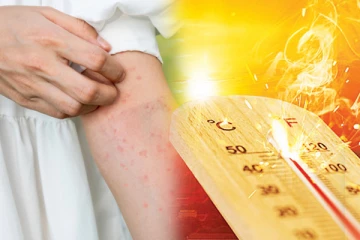 அதிக வெப்பநிலை : மக்களுக்கு விடுக்கப்பட்டுள்ள எச்சரிக்கை