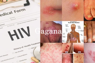 මෙරට HIV ආසාදිතයින් ඉහළට - වැඩි වූ රෝගීන් සංඛ්‍යාව මෙන්න.