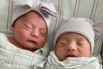 අවුරුදු 02කක ඉපදුන ලොවක් පුදුම කළ නිවුන් දරුවන් මෙන්න. (PHOTOS)