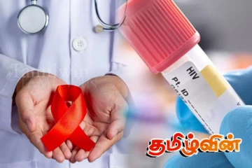 இலங்கையில் தீவிரமடையும் மற்றுமொரு ஆபத்து..! 7 தொற்றாளர்கள் தலைமறைவு