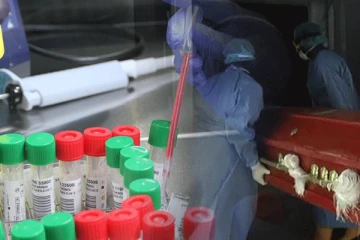 අද දින කොවිඩ් මරණ හා ආසාදිතයින් වෙනස්ම අගයක