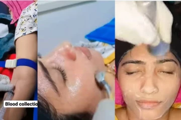 ரத்தத்தில் அழகு சிகிச்சை! பேரழகியாக மாறிய பிக் பாஸ் ஜூலி - இப்போ எப்படி இருக்கின்றார் தெரியுமா?