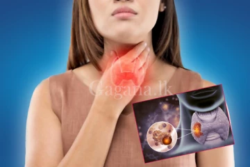 ‘‘වෙහෙස දැනෙනවද?? උගුරට අමාරුද??’’ (VIDEO)