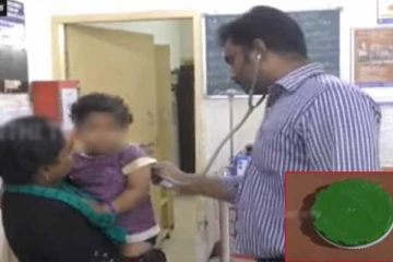 குழந்தையின் தொண்டையில் சிக்கிய பிளாஸ்டிக் டப்பா..போராடிய மருத்துவர்கள் - அதிர்ச்சி சம்பவம்!