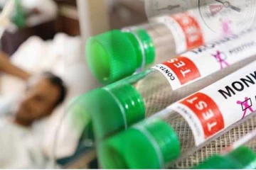 குரங்கம்மை தொடர்பில் உலக சுகாதார அமைப்பு வெளியிட்டுள்ள தகவல்