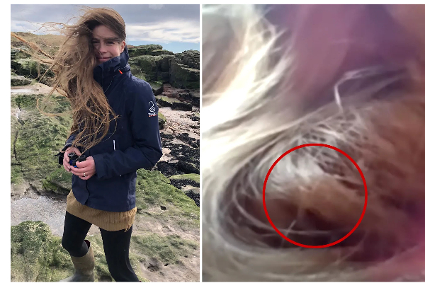 இளம் அழகியின் கூந்தலில் 84 நாட்கள் வாழ்ந்த பறவை! அதிசய சம்பவம் | Bird Live In Hair For 84 Days In Tamil