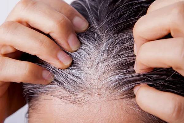 முடி நரைக்க என்ன காரணம் தெரியுமா? இதை உடனே சரிபண்ணுங்க | Do You Know What Causes Hair To Turn Gray
