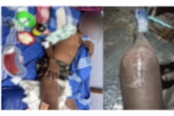 மாணவனை கொடூரமாக தாக்கிய ஆசிரியர் - நடக்க முடியாமல் முடங்கிய கொடுமை!