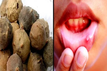 தீர்க்க முடியாத ஐந்து வகை நோய்களுக்கு மருந்தாகும் மாசிக்காய்! இனி கவலை வேண்டாம்!!