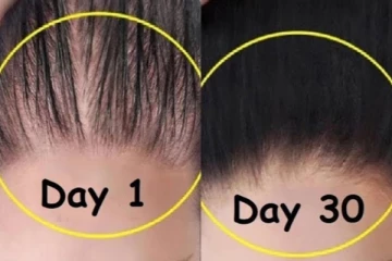 திட்டு திட்டாக கொட்டிய இடத்தில் முடி வளர எண்ணெய்! 15 நாளில் சூப்பரான ரிசல்ட்