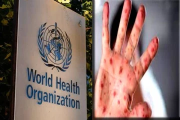 அதிகரிக்கும் குரங்கம்மை பாதிப்பு: உலக சுகாதார அமைப்பு விடுத்த வேண்டுகோள்-உலக செய்திகள்