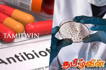 என்டிபயோட்டிக் பயன்பாடு : எச்சரிக்கை விடுக்கும் மருத்துவர்கள்