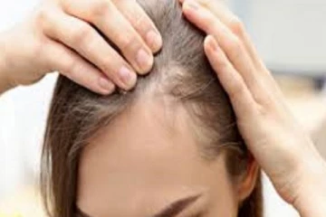 முன் நெற்றியில் முடி உதிர்கிறதா? வளர வைக்க ஈஸியான டிப்ஸ் இதோ..