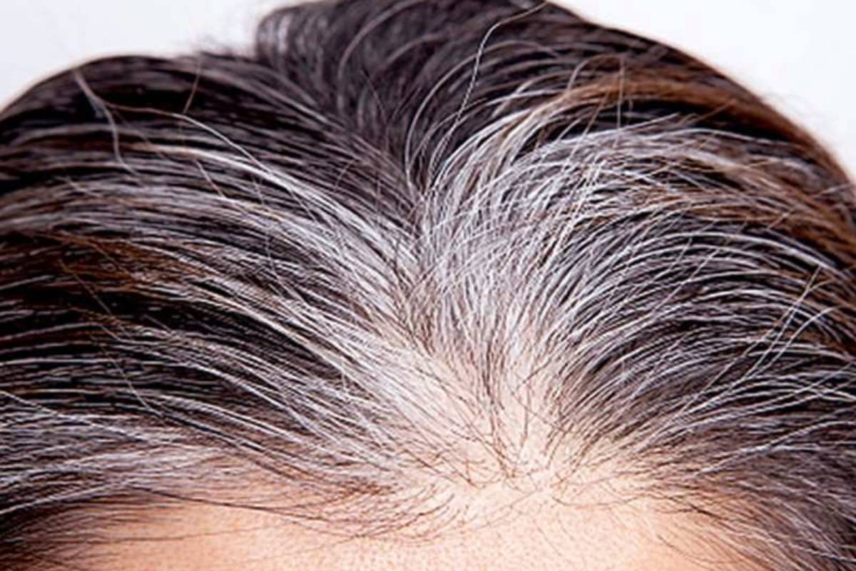 இனி இரசாயன சாயம் தேவையில்லை - கிராம்பு வாழைப்பழ தோல் இருந்தா போதும் | Natural Hair Dye Banana Peel Clove Give Black Hair