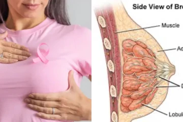 ඔබත් පියයුරු පිළිකා ලක්ෂණ සහිත කෙනෙක්ද? කල් තියා හදුනාගන්නේ මෙහෙමයි..