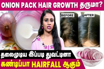 வெங்காய சாறு தேய்த்தால் முடி அடர்த்தியாக வளருமா? தினமும் மறக்காம இத மட்டும் செய்ங்க