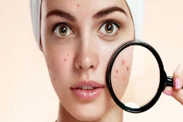 முகத்தில் ஒரு பரு வராமல் இருக்க இத மட்டும் Try பண்ணங்க!