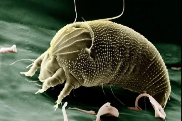 நாகரீகத்தின் உச்சியிலிருக்கும் சுவிஸ் நகரம் ஒன்றில் பரவும் மோசமான நோய்