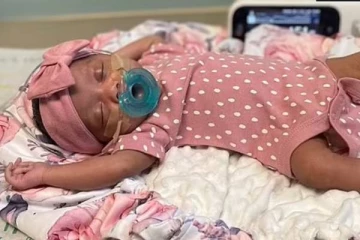 உலகிலேயே முதல் முறையாக தாயின் வயிற்றில் உள்ள குழந்தைக்கு அறுவை சிகிச்சை!