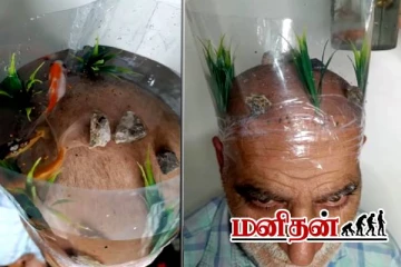 வழுக்கை தலையில் மீன் தொட்டியா? முதியவர் தலையில் இளைஞர் செய்த சாகசம்