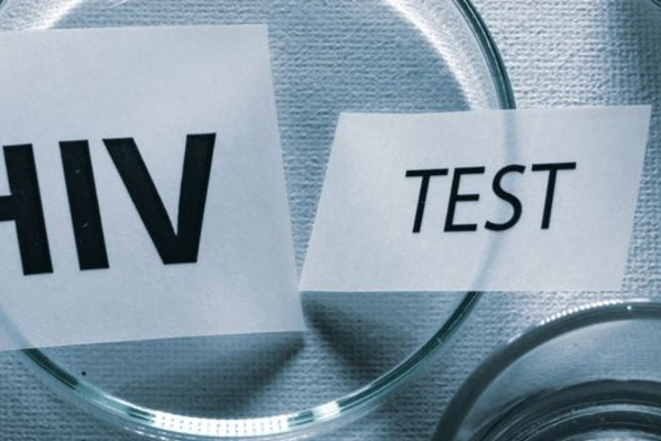 இலங்கையில் எய்ட்ஸ் பாதிப்பு ஏழு மடங்காக அதிகரிப்பு | National Aids Control Programme Testing For Hiv