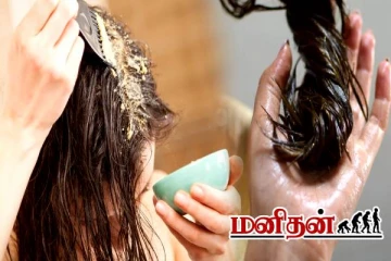 இந்த பேக் போடுங்க.. பொடுகு தொல்லை தீரும்!