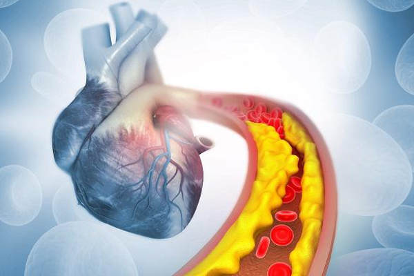 நம் உயிருக்கு வேட்டுவைக்கும் கொலஸ்ட்ராலை கொல்ல இலகு வழி! | Easy Way To Kill Life Killing Cholesterol