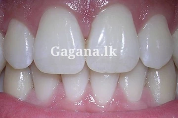 දත් 38ක කතක් තිබ්බ අමුතුම වාර්තාව - බලන්නකෝ ඒ කොහොමද කියලා.. (PHOTOS)