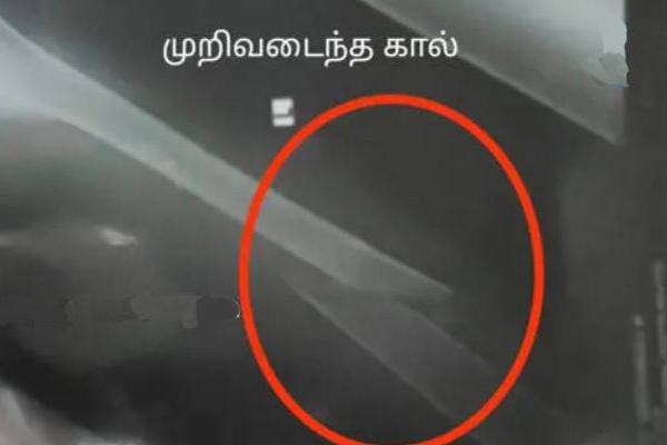 மாற்றுத்திறனாளி மீது கொடூர தாக்குதல்! வெளியான பகீர் பின்னணி | Mullaitivu Oddusuddan Attack Abled Person Land மாற்றுத்திறனாளி மீது கொடூர தாக்குதல்! வெளியான பகீர் பின்னணி | Mullaitivu Oddusuddan Attack Abled Person Land