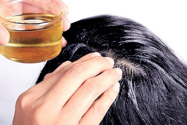 வழுக்கை விழுவதை மாற்றுவதற்கான இயற்கை வழிகள் - வாரம் இரு முறை செய்ங்க | Alopecia Areata Balding Natural Ways Remedies Hair வழுக்கை விழுவதை மாற்றுவதற்கான இயற்கை வழிகள் - வாரம் இரு முறை செய்ங்க | Alopecia Areata Balding Natural Ways Remedies Hair