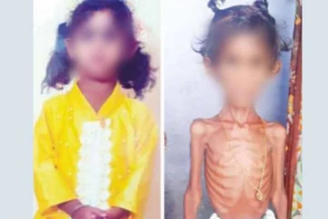 சர்க்கரை என பிளிச்சிங் பவுடரை சாப்பிட்ட சிறுமி- சில நாட்களுக்கு பின்பு காத்திருந்த பேரதிர்ச்சி!